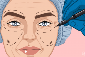 Cosmetic Surgeon Procedures | CrunchyTales